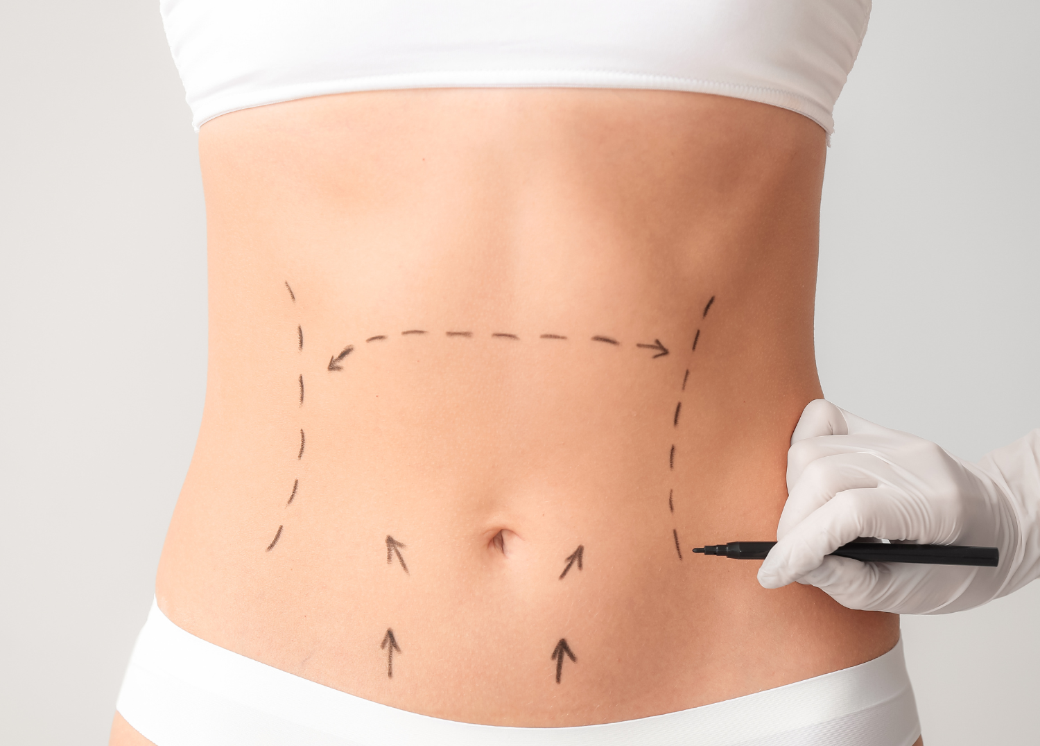 Plastic Surgery Across the U.S. and How to Minimize Scarring with Skinuva Scar & Skinuva Scar+ SPF