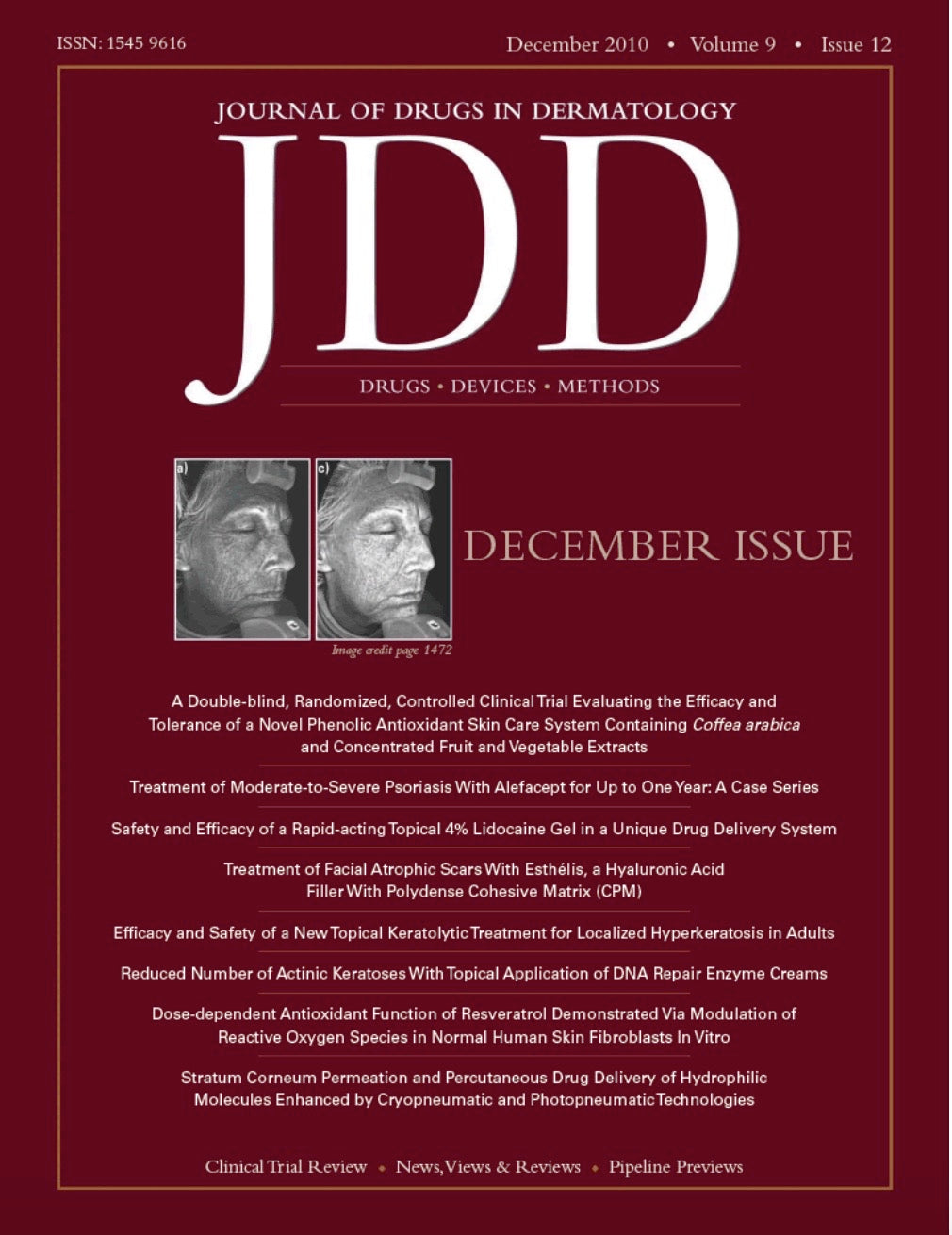 STUDY 2: Skinuva Scar reduces the need for post surgical intralesional steroid and 5- Fluorouracil injections
