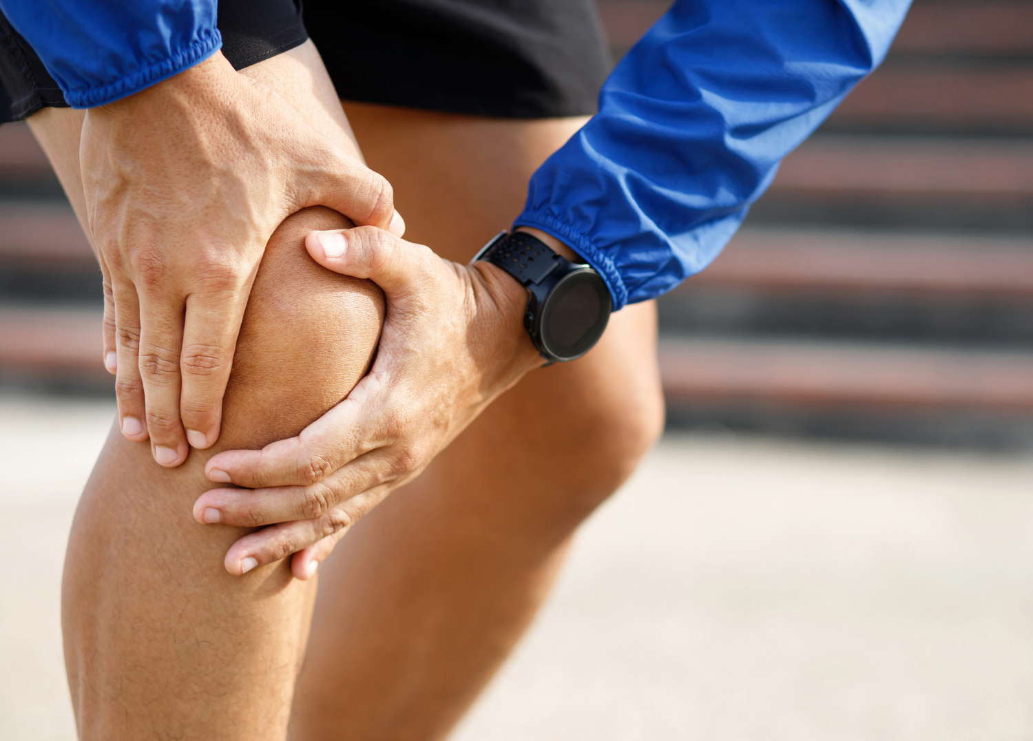 Arthritis in the Joints: How Topical Arnica Cream Can Help Relieve Pain and Swelling