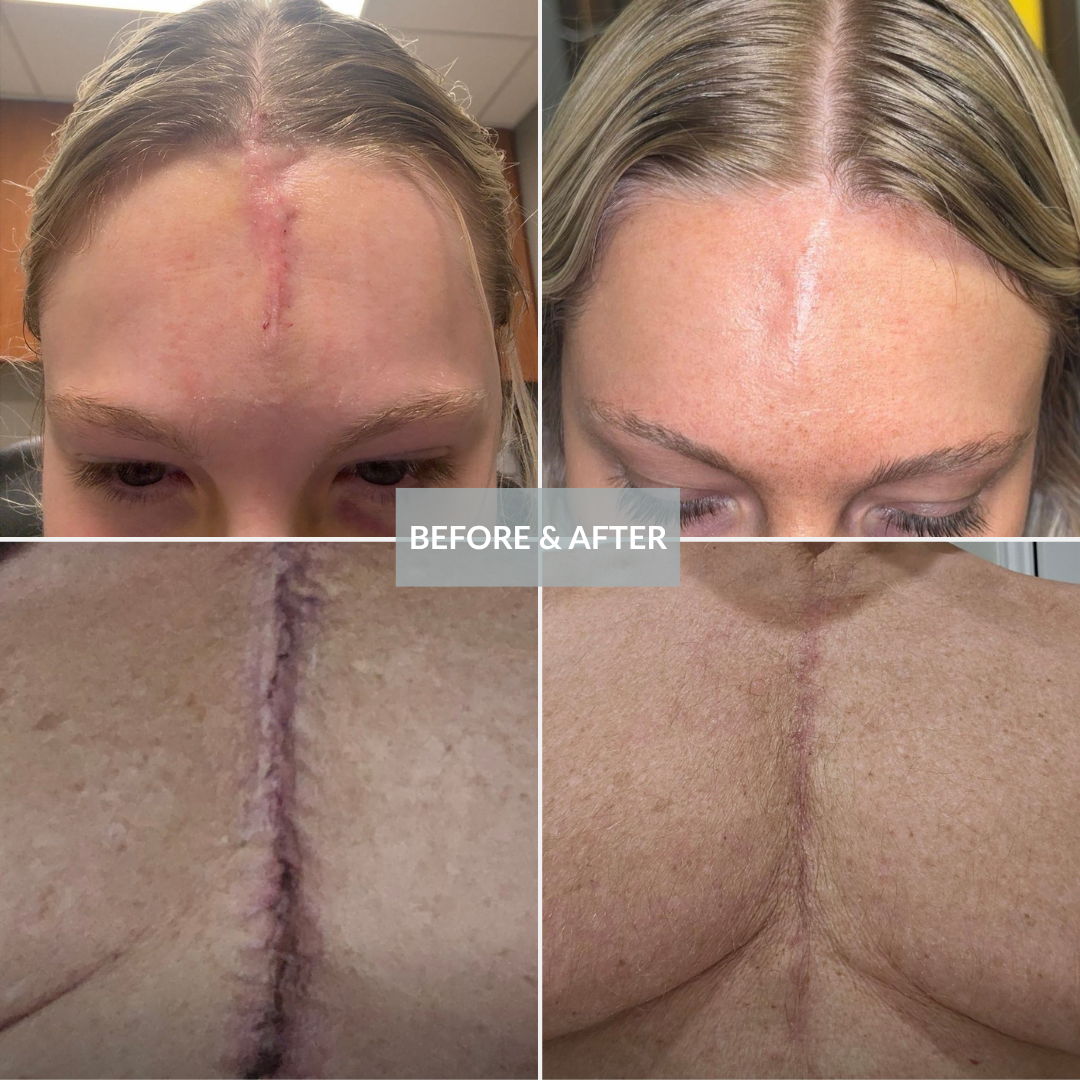 Skinuva Scar