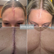 Skinuva Scar
