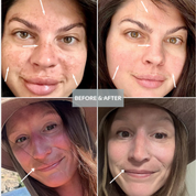 Skinuva Brite