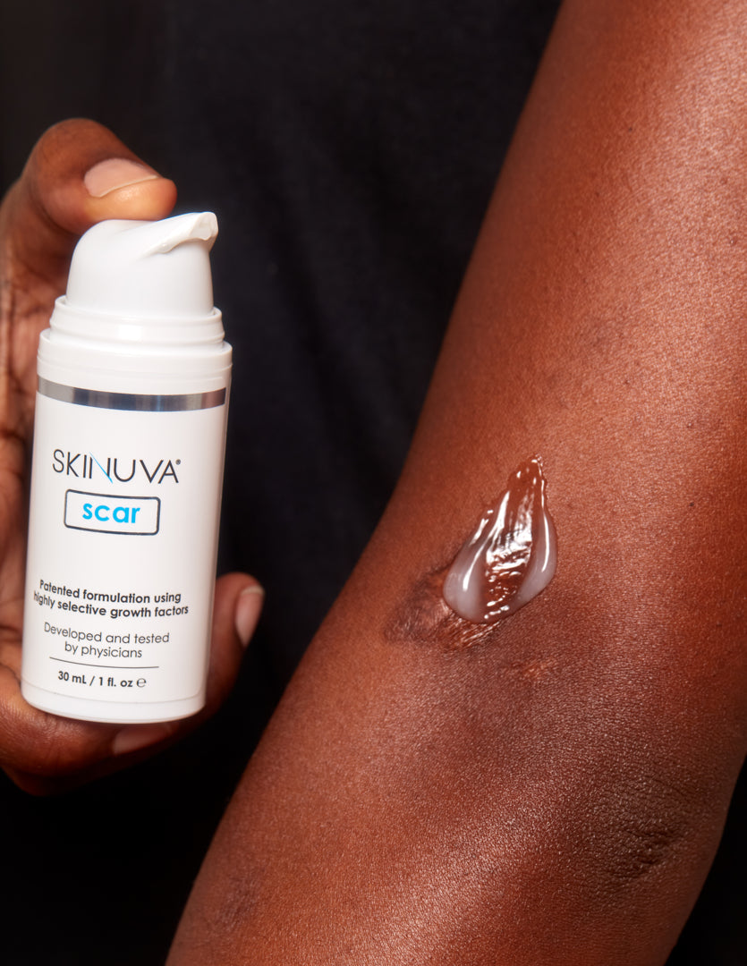 Skinuva_-_Feb2024_19.jpg